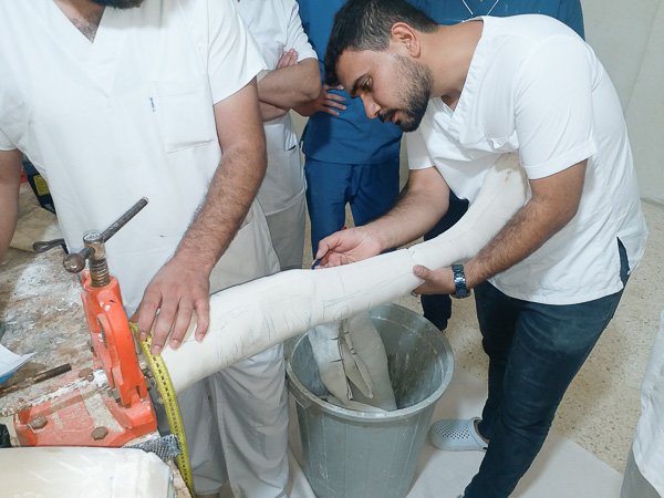 a student modifying plaster positive cast for knee ankle foot orthosis